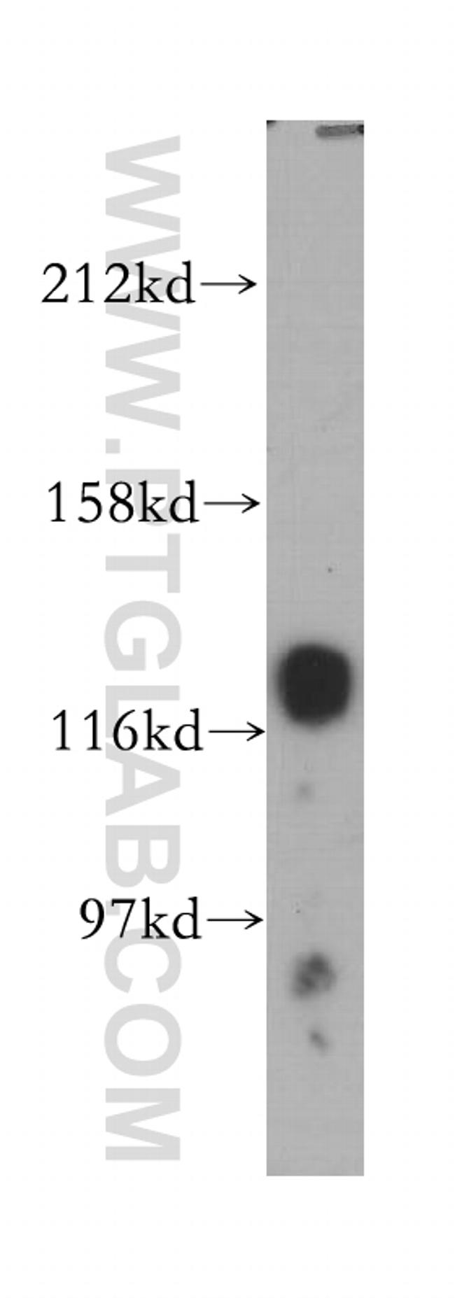 HNRNPU Antibody in Western Blot (WB)