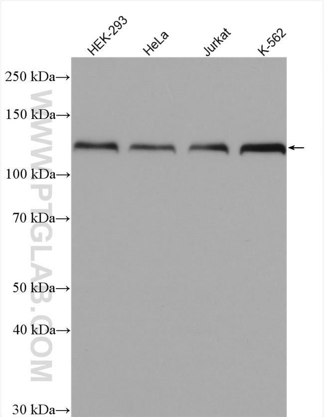 HNRNPU Antibody in Western Blot (WB)