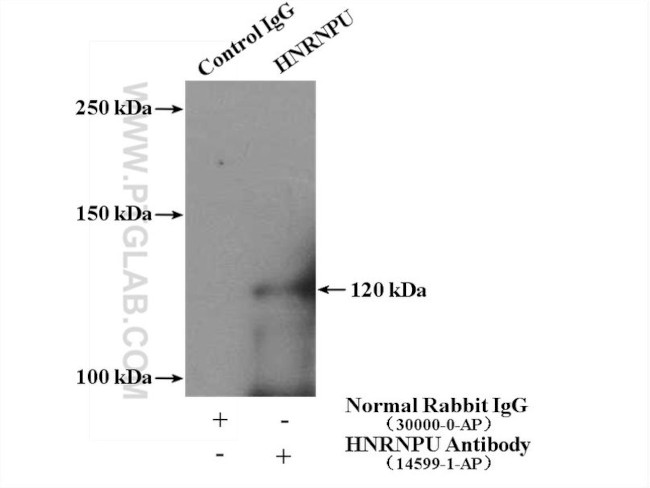 HNRNPU Antibody in Immunoprecipitation (IP)