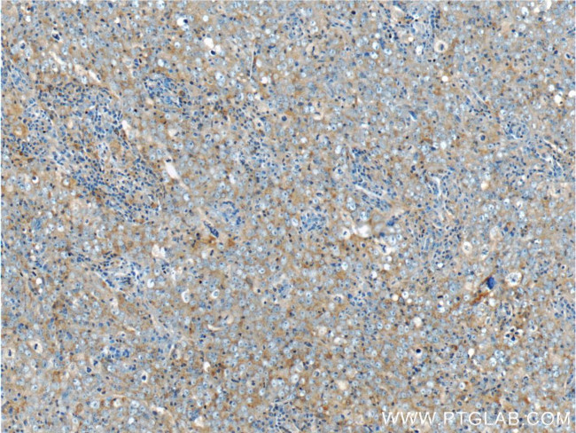 LC3 Antibody in Immunohistochemistry (Paraffin) (IHC (P))