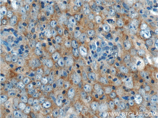 LC3 Antibody in Immunohistochemistry (Paraffin) (IHC (P))