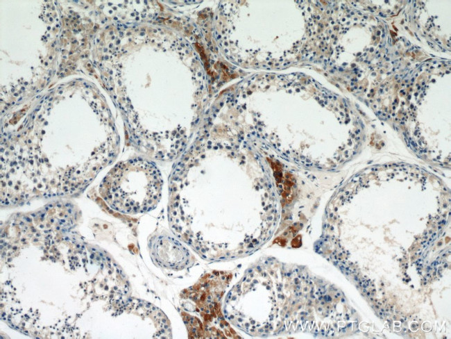 LC3 Antibody in Immunohistochemistry (Paraffin) (IHC (P))