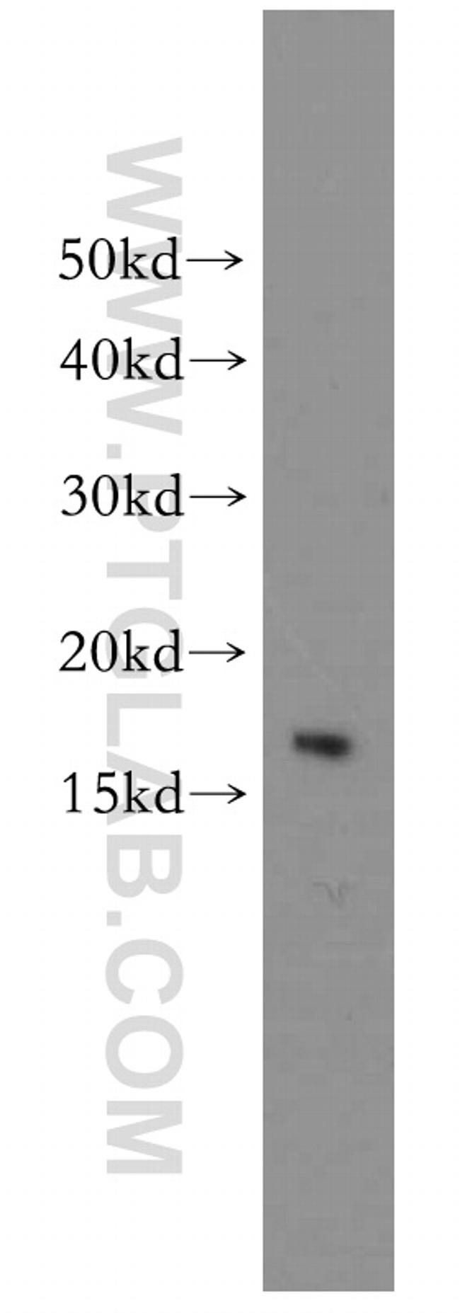 LC3 Antibody in Western Blot (WB)