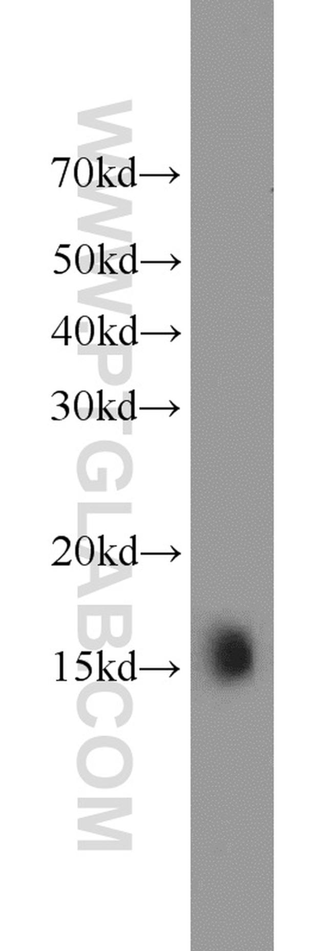 LC3 Antibody in Western Blot (WB)