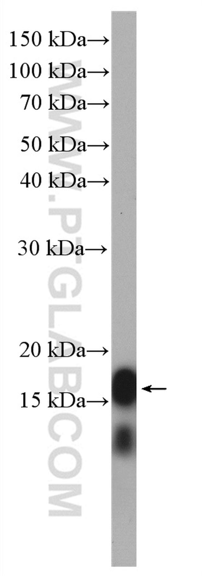 LC3 Antibody in Western Blot (WB)