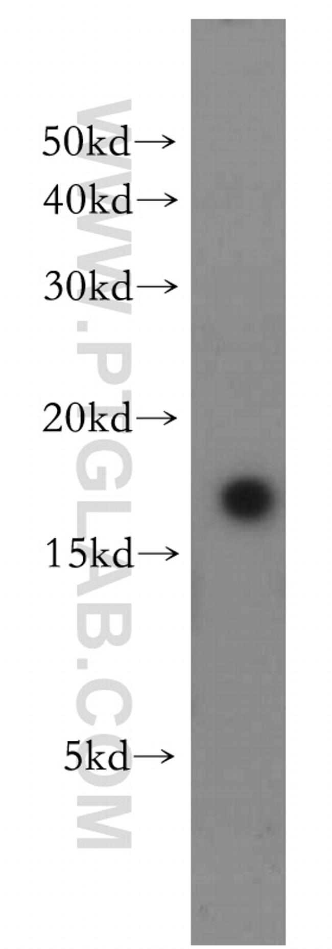 LC3 Antibody in Western Blot (WB)