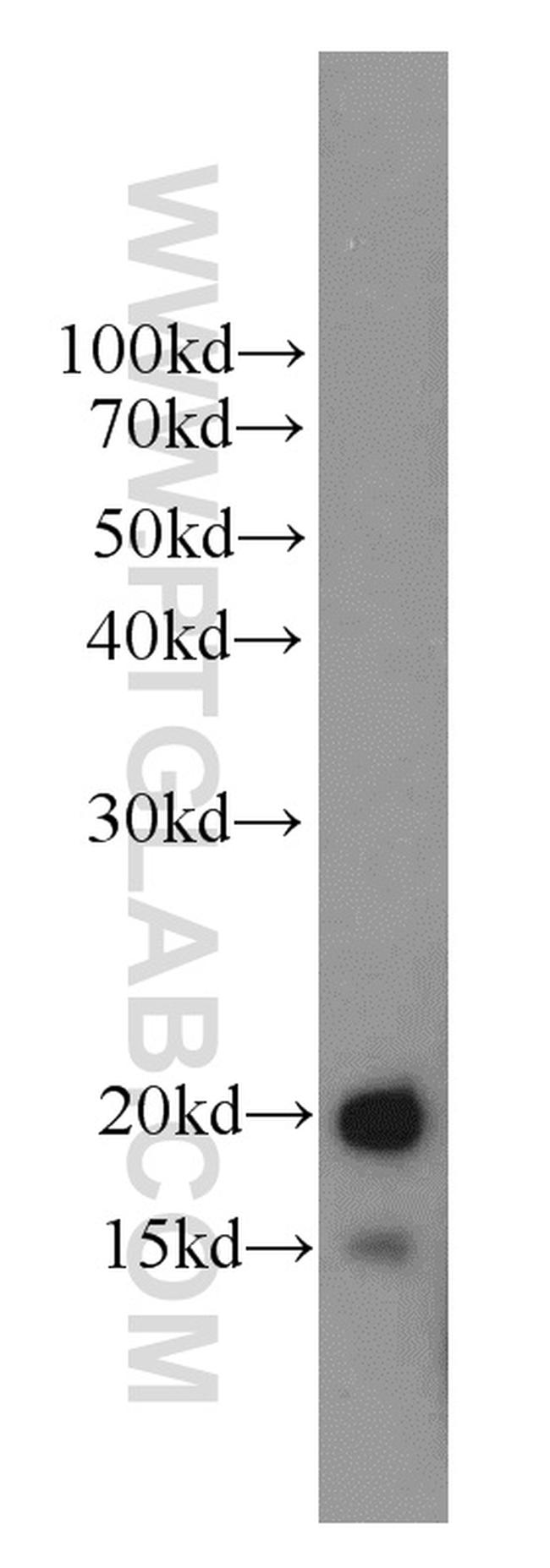 LC3 Antibody in Western Blot (WB)