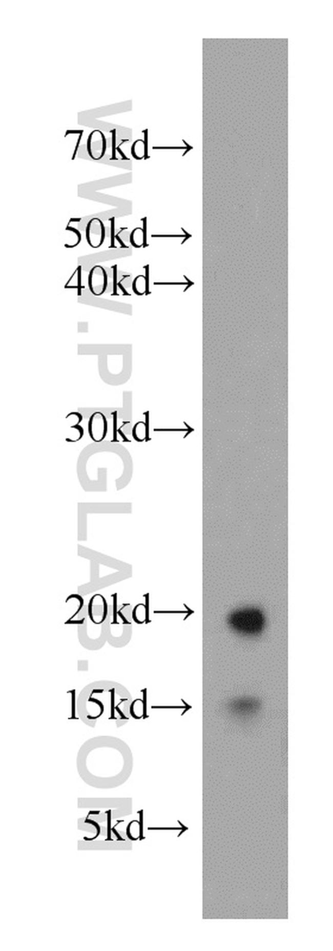 LC3 Antibody in Western Blot (WB)