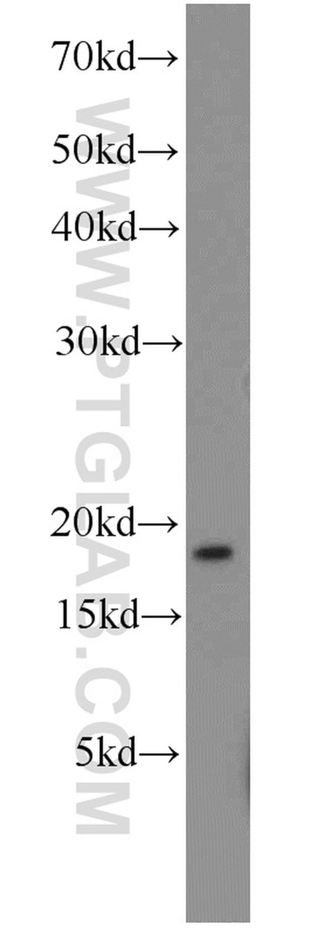 LC3 Antibody in Western Blot (WB)