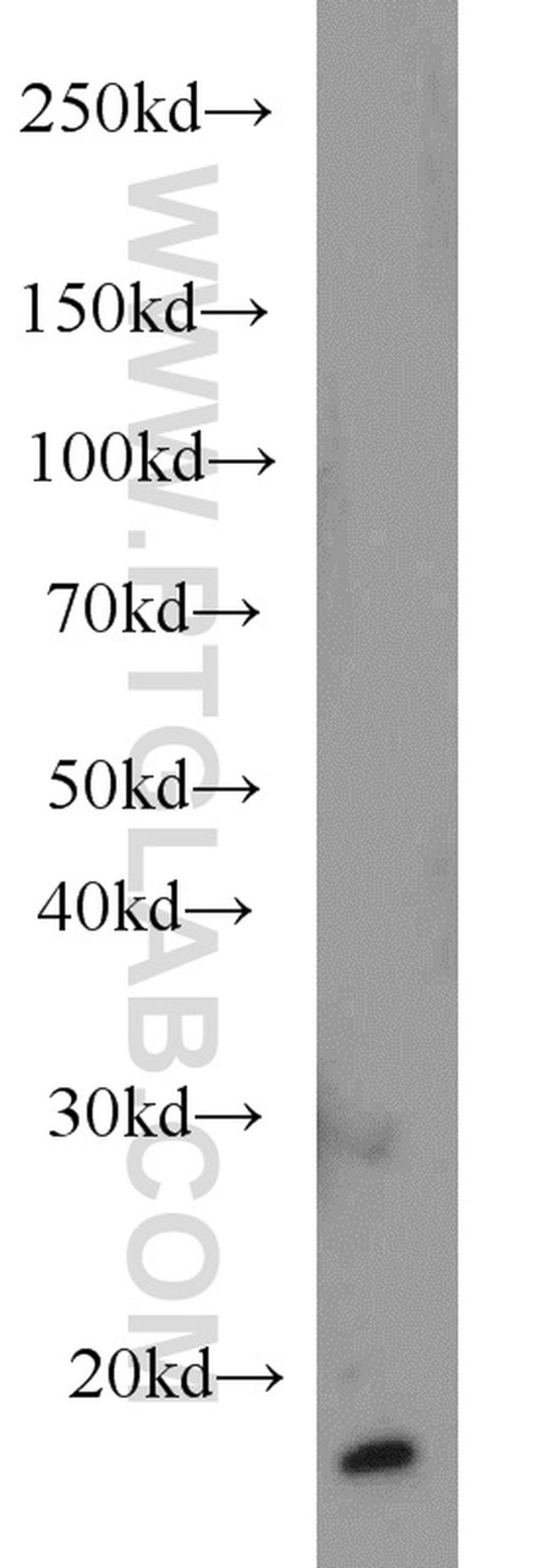 LC3 Antibody in Western Blot (WB)