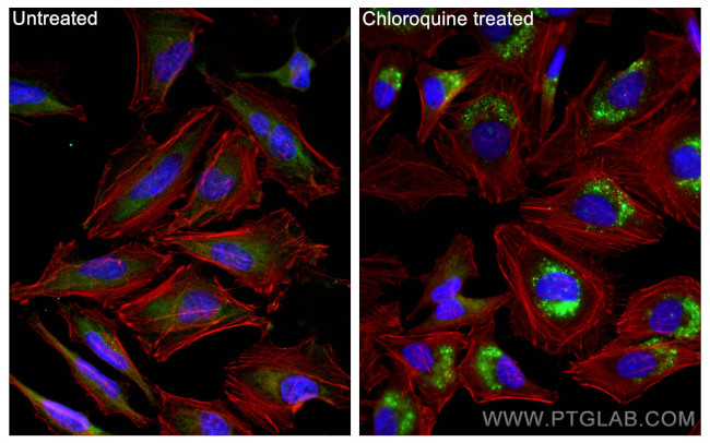 LC3 Antibody in Immunocytochemistry (ICC/IF)