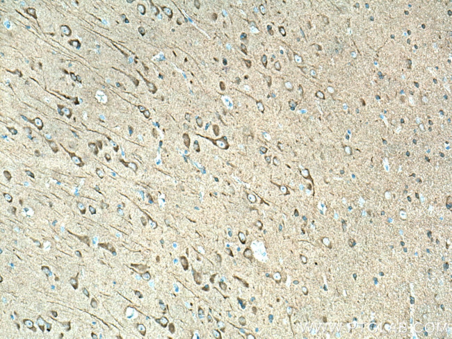 LC3 Antibody in Immunohistochemistry (Paraffin) (IHC (P))