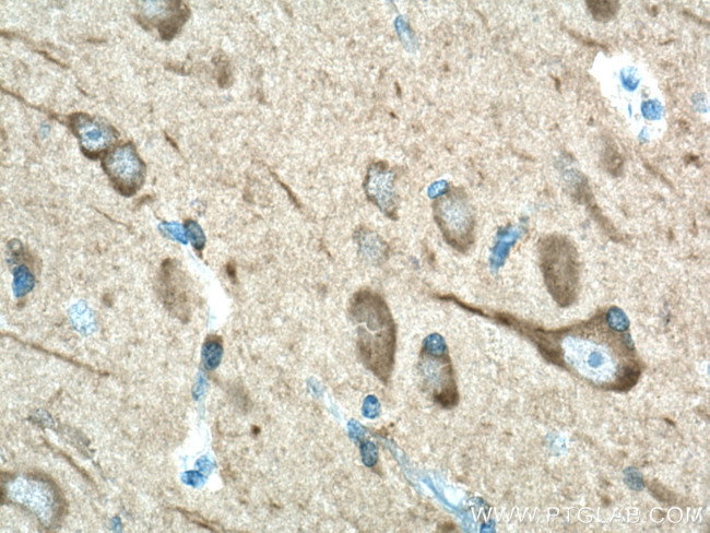 LC3 Antibody in Immunohistochemistry (Paraffin) (IHC (P))