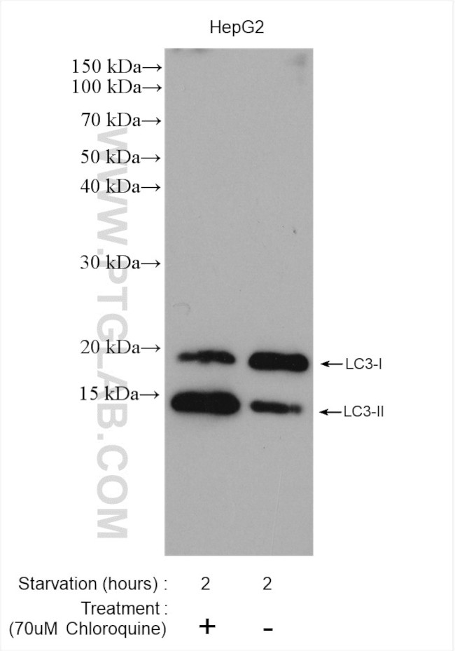 LC3 Antibody in Western Blot (WB)