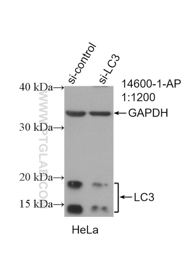 LC3 Antibody in Western Blot (WB)