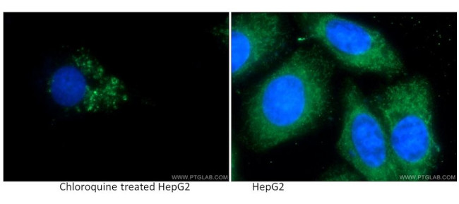 LC3 Antibody in Immunocytochemistry (ICC/IF)