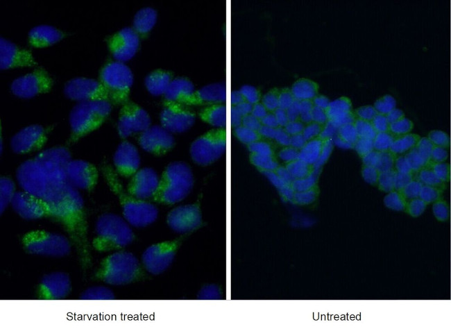 LC3 Antibody in Immunocytochemistry (ICC/IF)