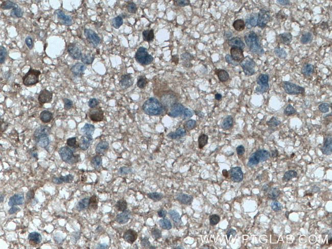 LC3 Antibody in Immunohistochemistry (Paraffin) (IHC (P))