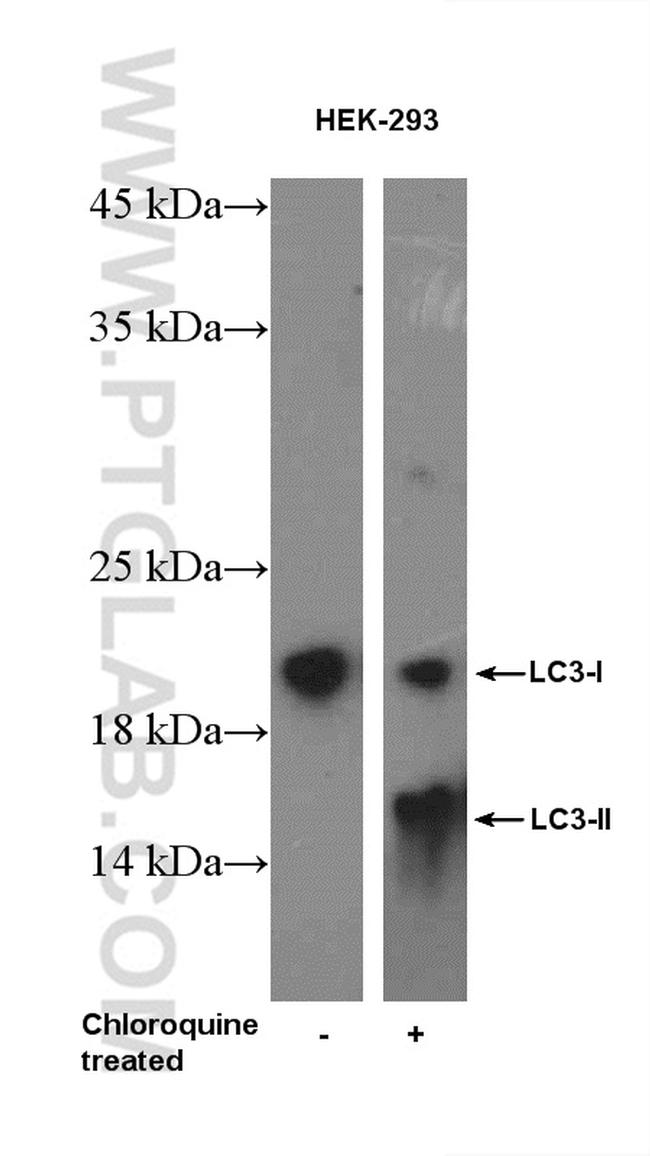 LC3 Antibody in Western Blot (WB)