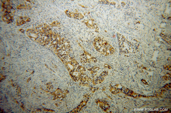 B3GALTL Antibody in Immunohistochemistry (Paraffin) (IHC (P))