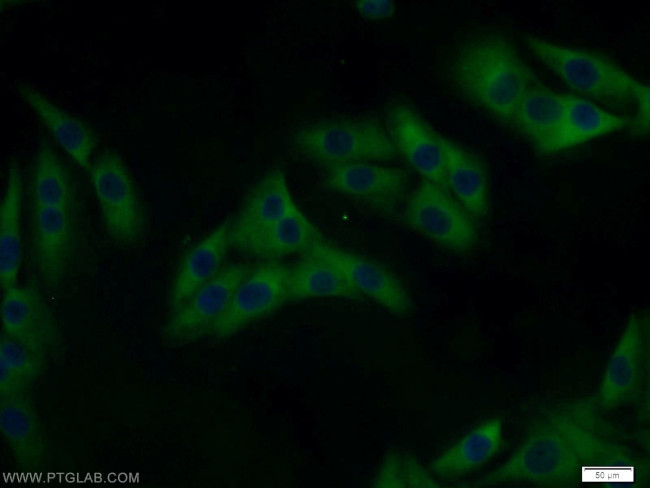 MAGEA6 Antibody in Immunocytochemistry (ICC/IF)