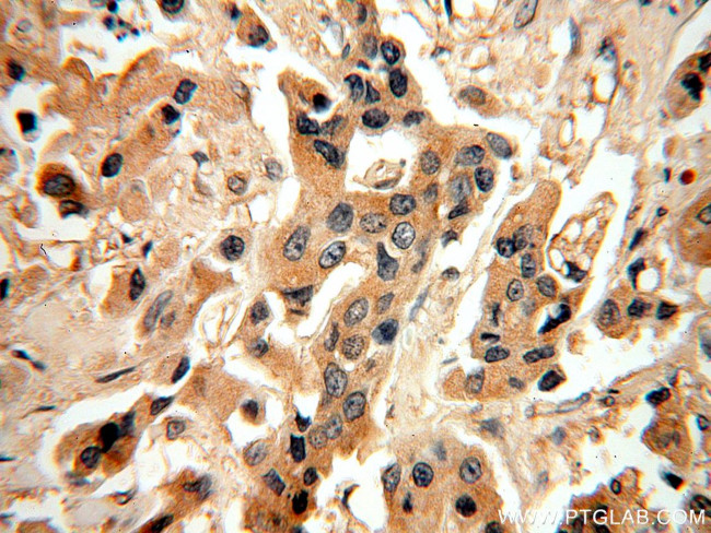 MAGEA6 Antibody in Immunohistochemistry (Paraffin) (IHC (P))