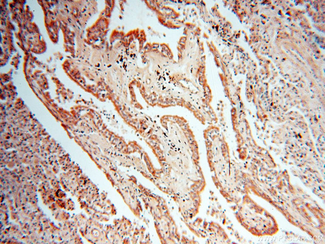 MAGEA6 Antibody in Immunohistochemistry (Paraffin) (IHC (P))