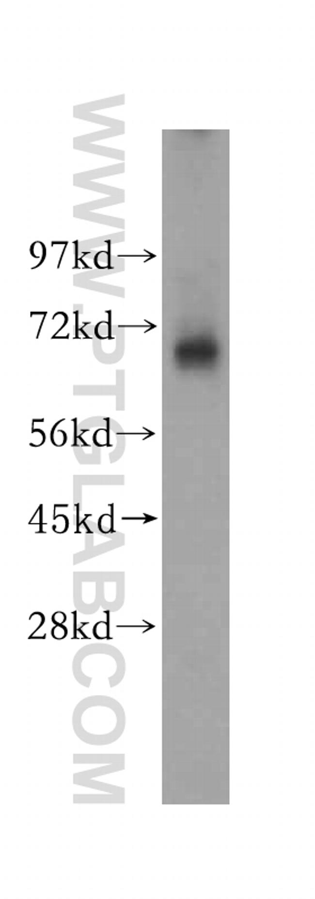 MAGEA6 Antibody in Western Blot (WB)