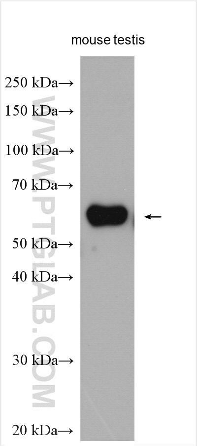 TCP11 Antibody in Western Blot (WB)