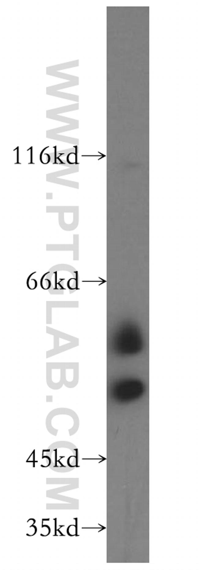 TCP11 Antibody in Western Blot (WB)