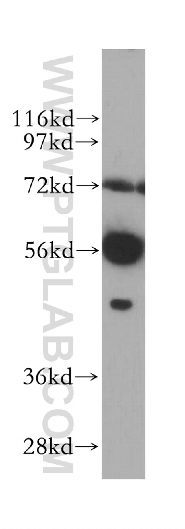 TCP11 Antibody in Western Blot (WB)