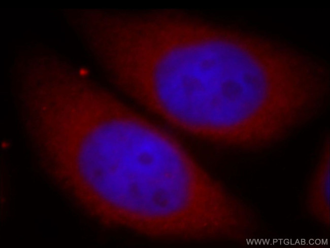 PKN2 Antibody in Immunocytochemistry (ICC/IF)