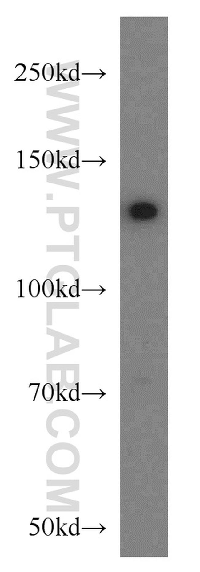 PKN2 Antibody in Western Blot (WB)