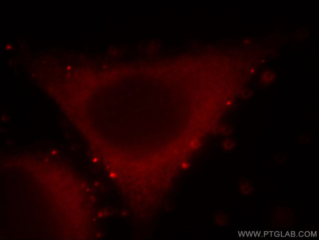 PKN2 Antibody in Immunocytochemistry (ICC/IF)