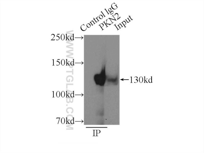 PKN2 Antibody in Immunoprecipitation (IP)