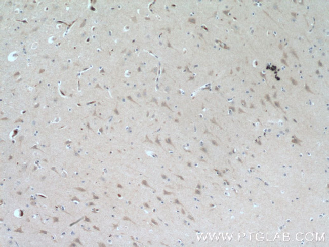 SMPD1/ASM Antibody in Immunohistochemistry (Paraffin) (IHC (P))