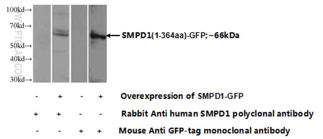 SMPD1/ASM Antibody in Western Blot (WB)