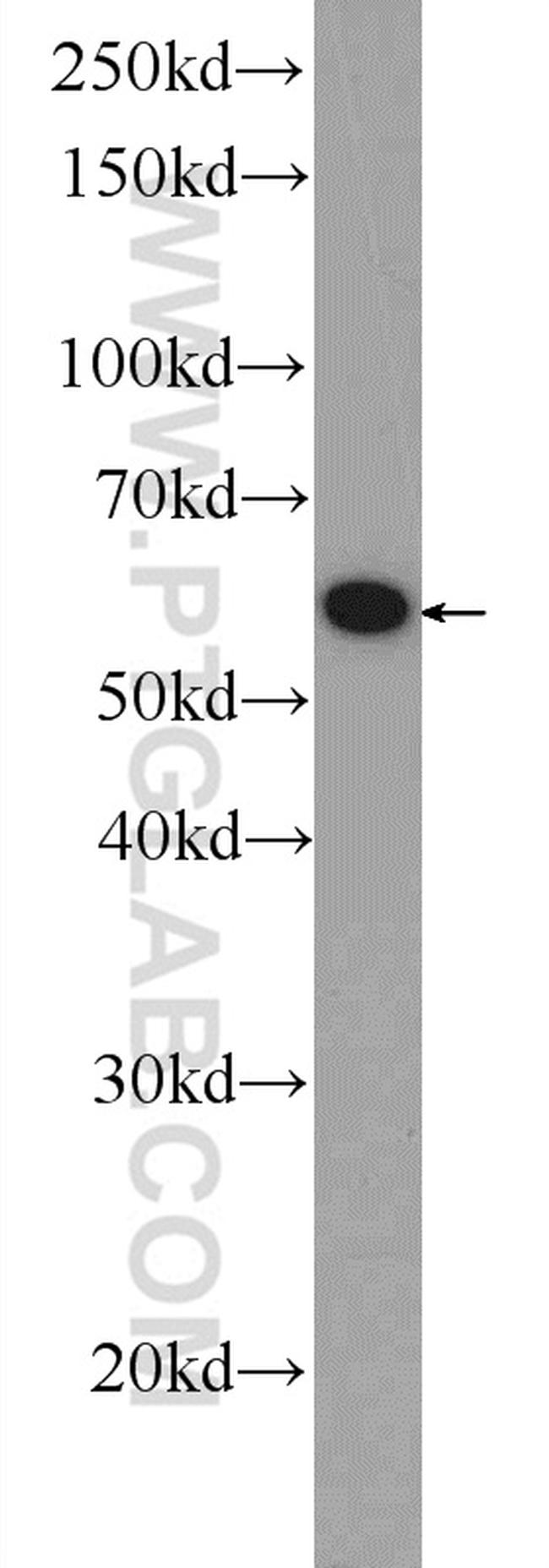 SMPD1/ASM Antibody in Western Blot (WB)