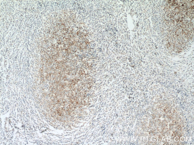 SMPD1/ASM Antibody in Immunohistochemistry (Paraffin) (IHC (P))