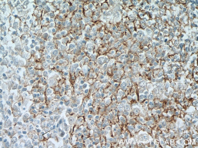 SMPD1/ASM Antibody in Immunohistochemistry (Paraffin) (IHC (P))