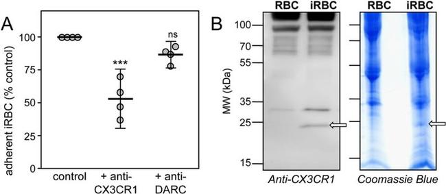 CX3CR1 Antibody in Western Blot (WB)