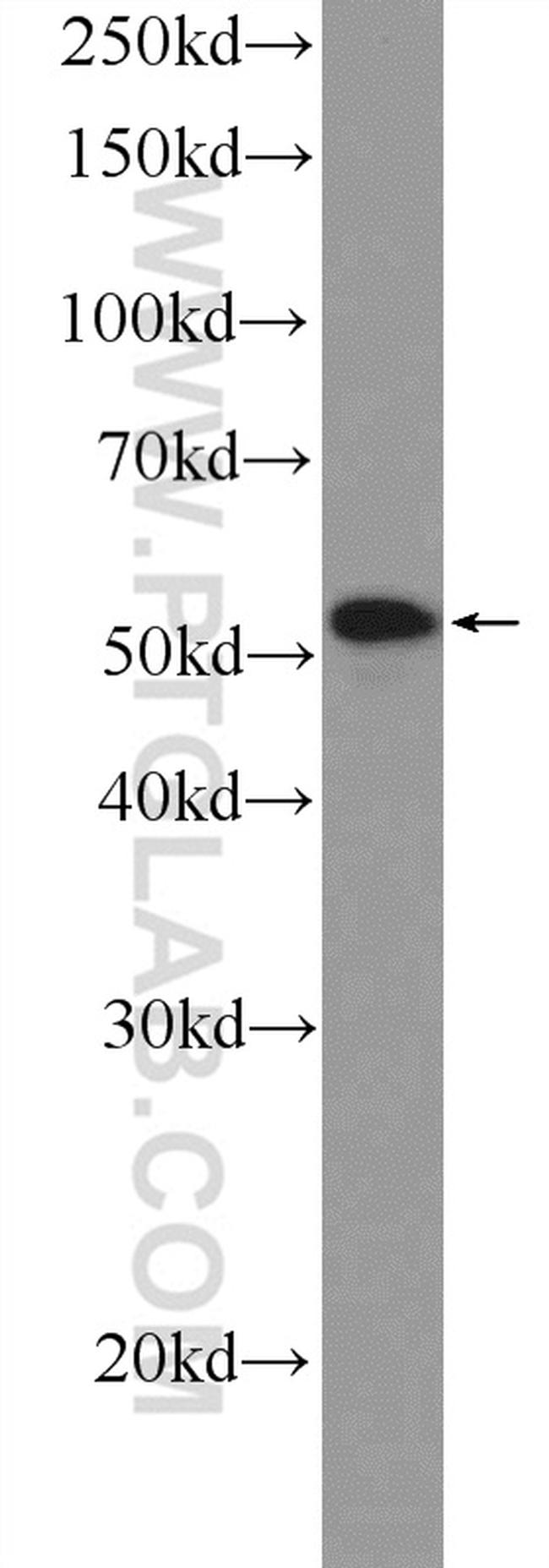 NEUROD4 Antibody in Western Blot (WB)