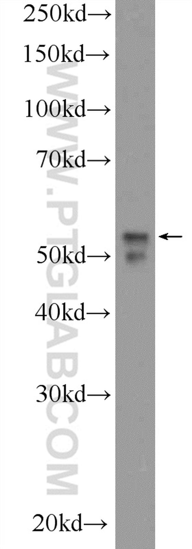 NEUROD4 Antibody in Western Blot (WB)