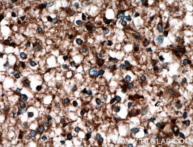 LAP3 Antibody in Immunohistochemistry (Paraffin) (IHC (P))