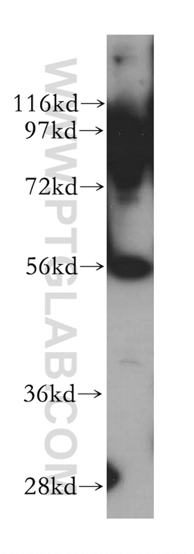 LAP3 Antibody in Western Blot (WB)