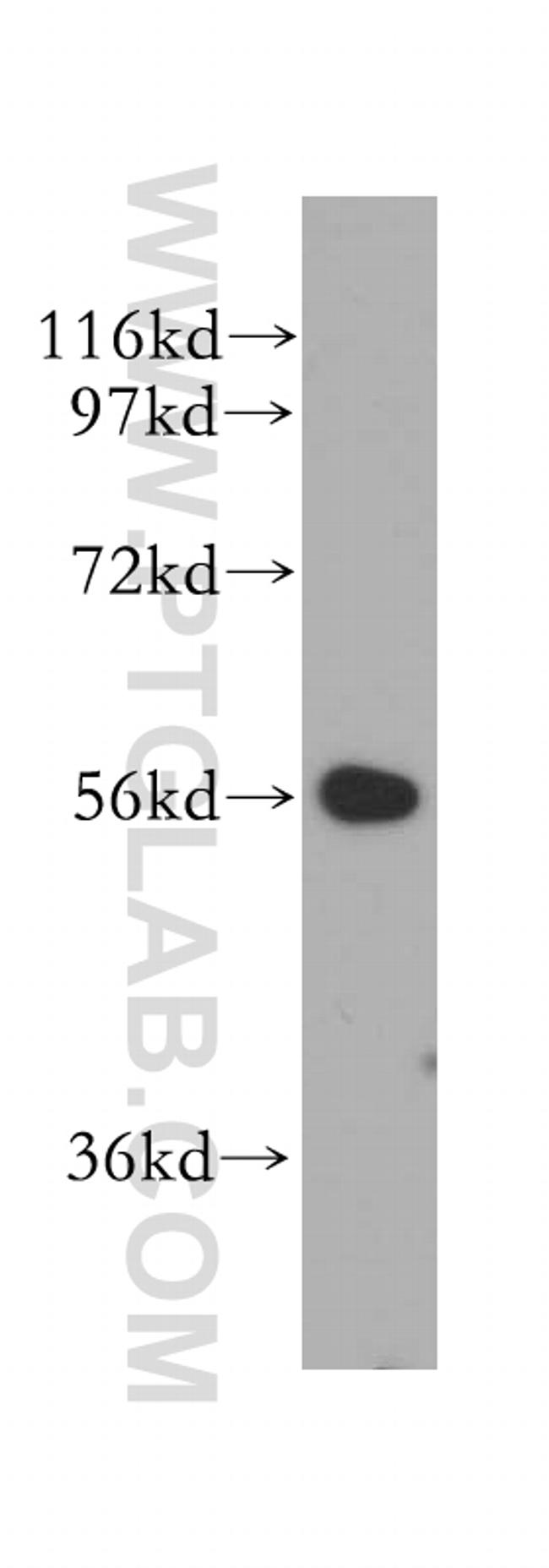 LAP3 Antibody in Western Blot (WB)