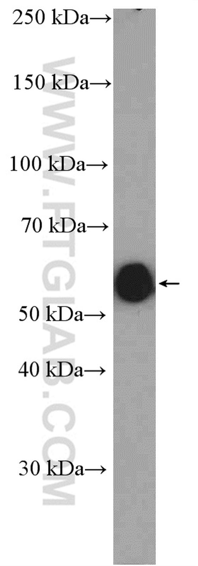 LAP3 Antibody in Western Blot (WB)