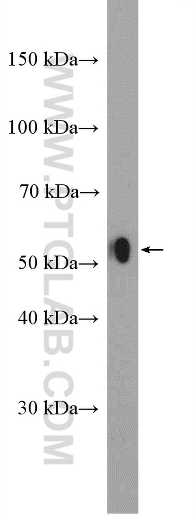 LAP3 Antibody in Western Blot (WB)