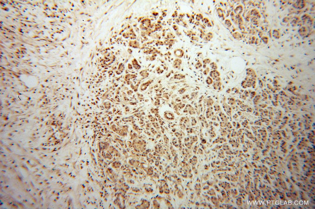 RBPJ Antibody in Immunohistochemistry (Paraffin) (IHC (P))