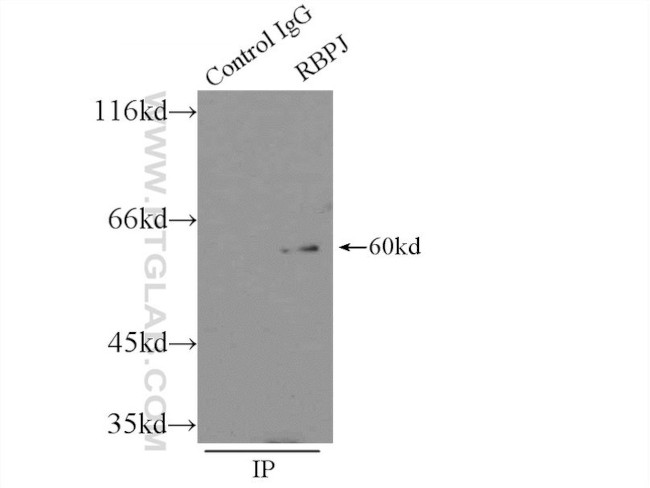 RBPJ Antibody in Immunoprecipitation (IP)